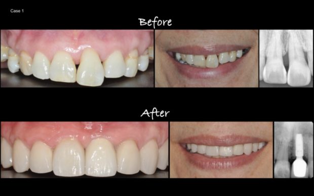 Periodontist In Woodland Hills Ca Photo Gallery Brighton Periodontal