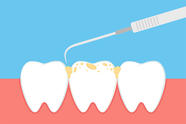 https://www.periocafe.com/wp-content/uploads/what-your-periodontist-wants-you-to-know-about-plaque-and-tartar.jpg